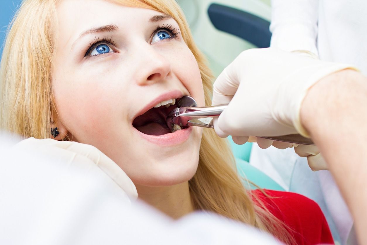 A una mujer le están extrayendo los dientes un dentista.