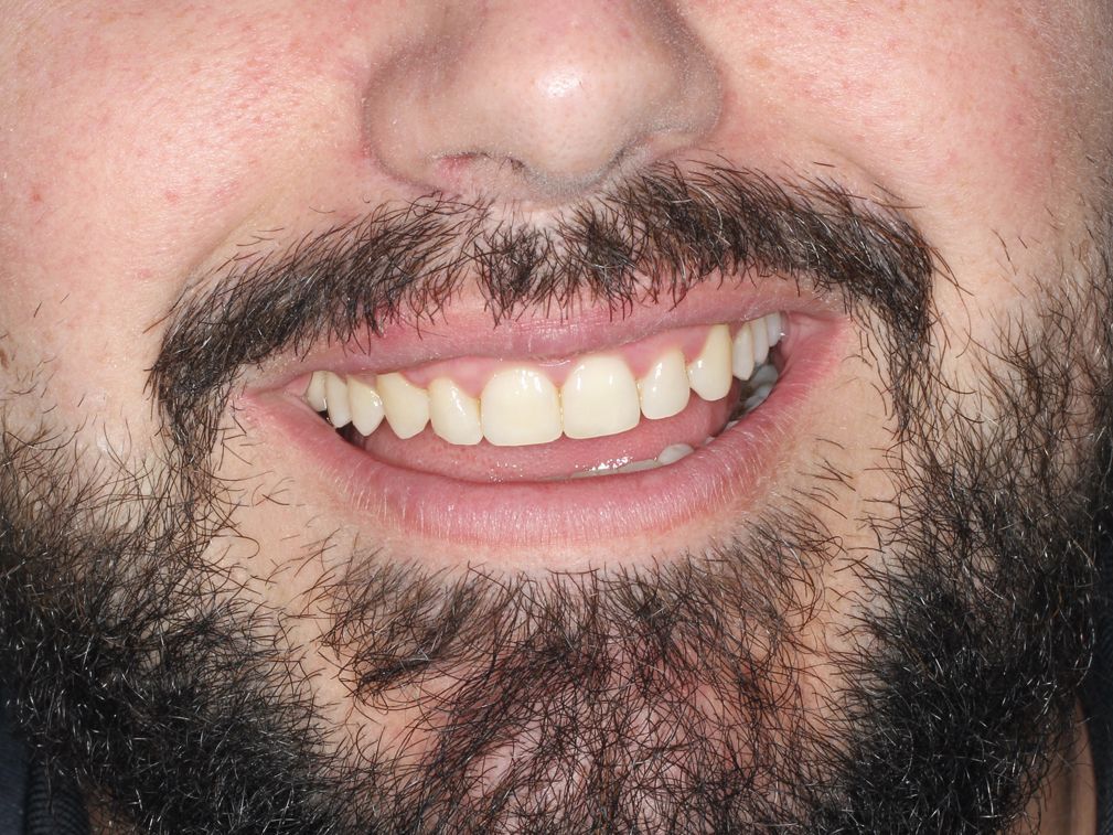 Primer plano de un hombre sonriente con barba oscura, mostrando dientes blancos.