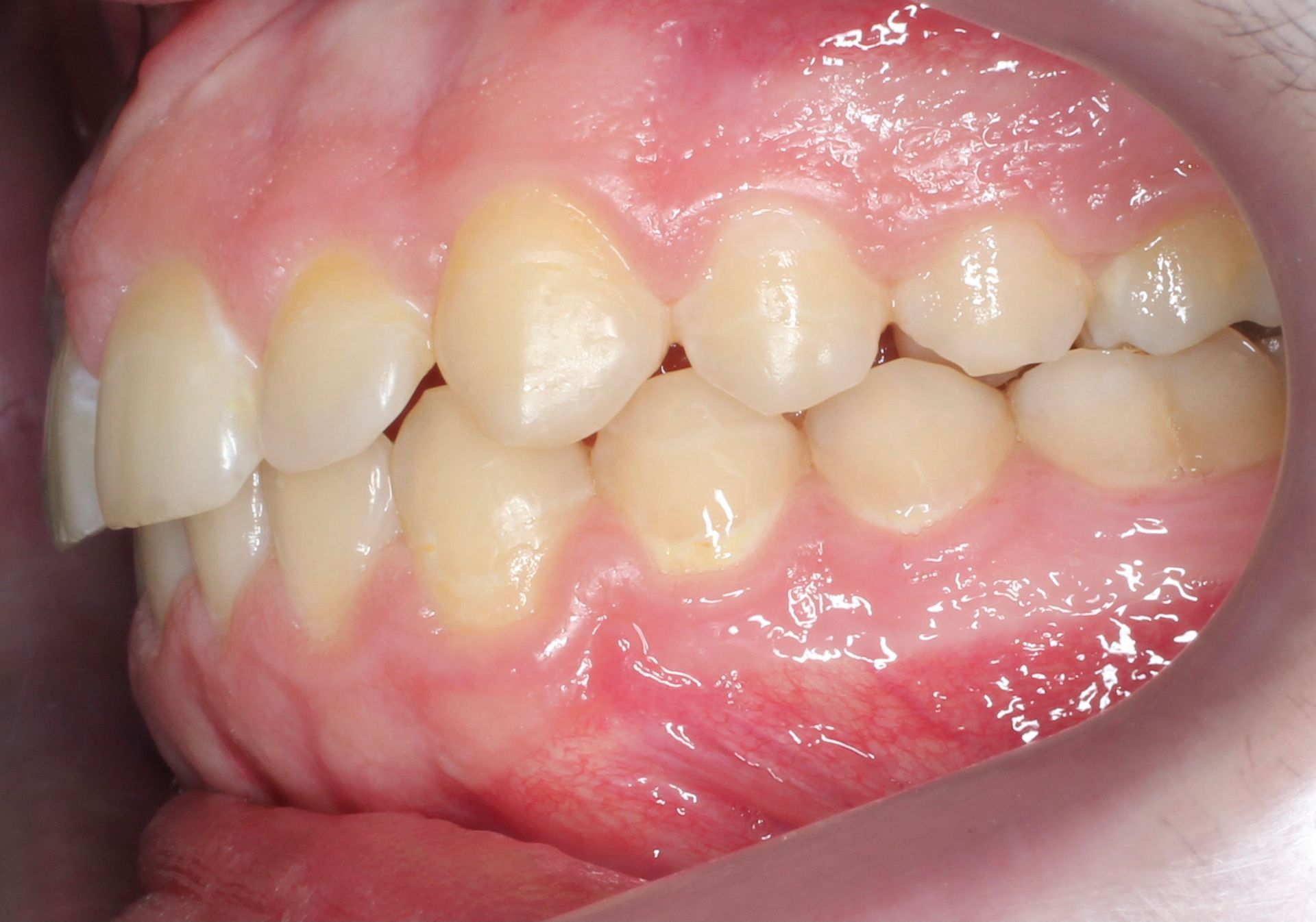 Un primer plano de la sonrisa de una mujer con dientes blancos.
