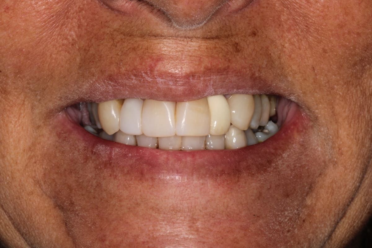 Un primer plano de la sonrisa de una mujer con dientes blancos.
