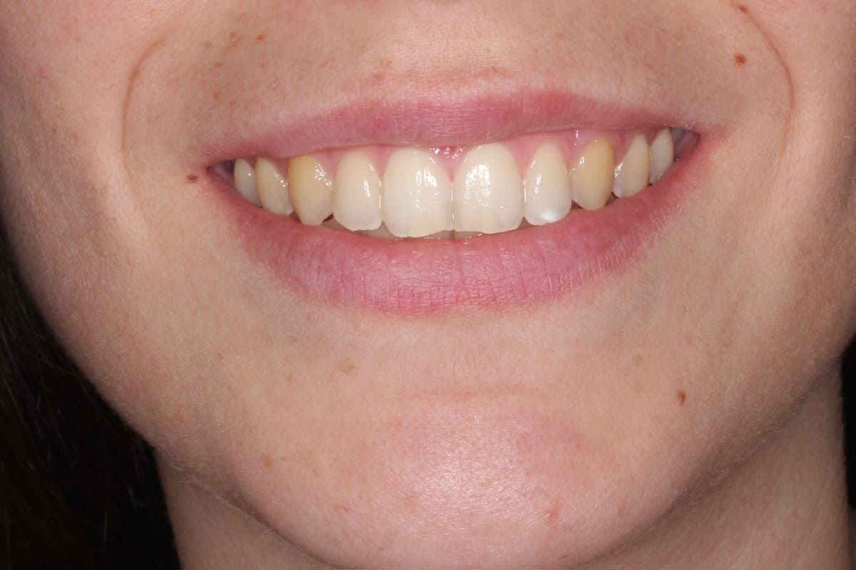 Un primer plano de la boca de una mujer con una sonrisa y pendientes.