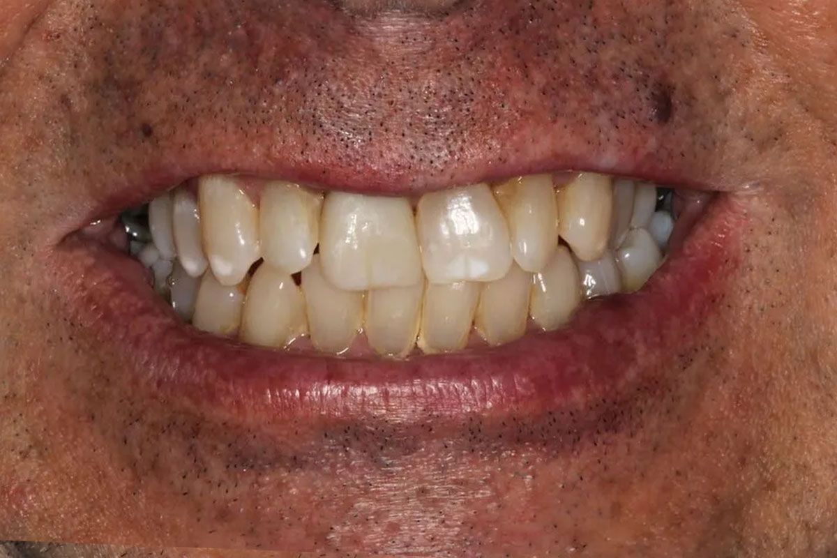 Un primer plano de la sonrisa de una mujer con dientes blancos.