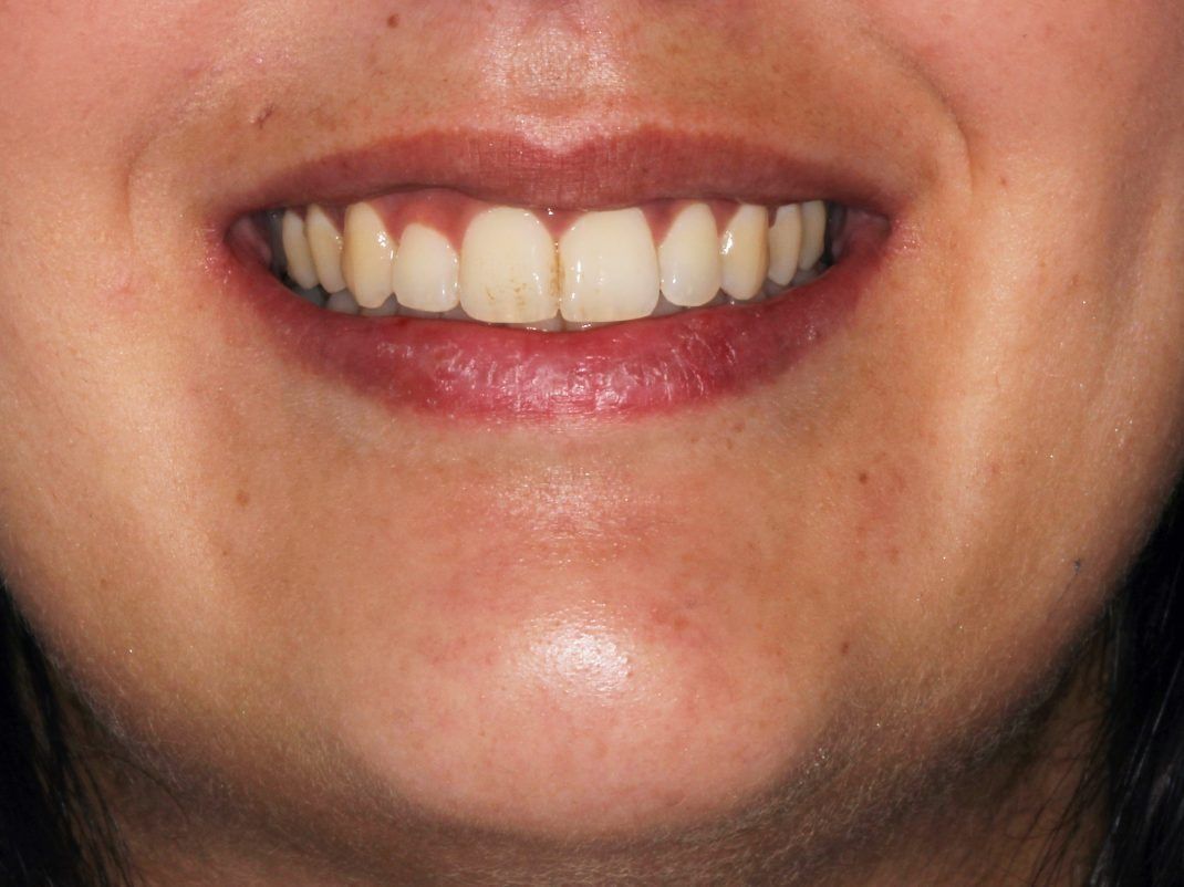 Un primer plano de la boca de una mujer con dientes blancos y labios rojos.