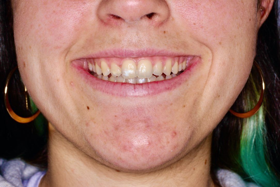 Un primer plano de la boca de una mujer con una sonrisa y pendientes.