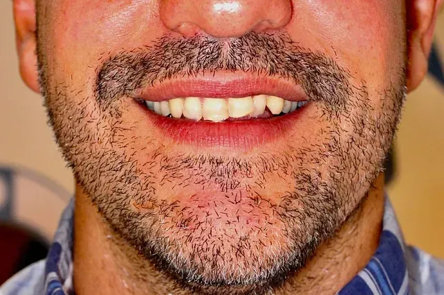 Un hombre con barba sonríe con la boca abierta.