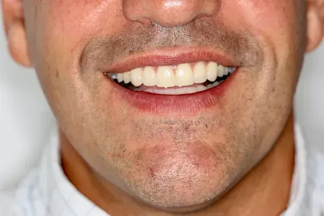 Un primer plano de la cara de un hombre con una sonrisa en su rostro.