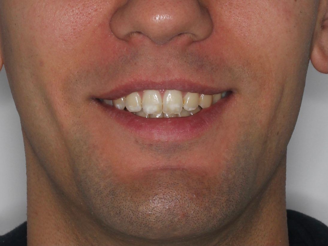 Un primer plano de la cara de un hombre con una sonrisa en su rostro.