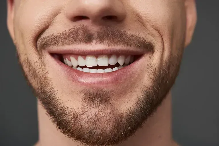 Un hombre con barba sonríe con la boca abierta.