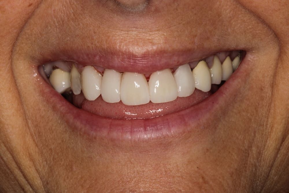 Un primer plano de la sonrisa de una mujer con dientes blancos.