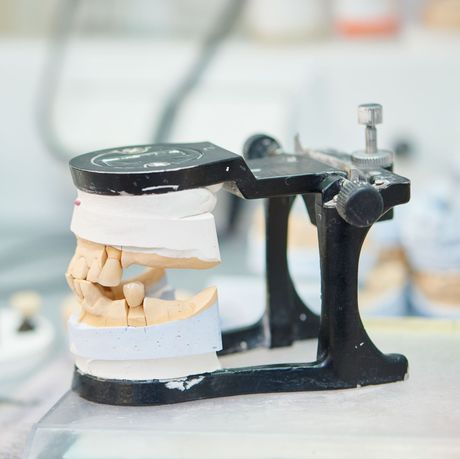 Modelo de mordida dental en un articulador metálico sobre una mesa de trabajo, que muestra secciones de dientes blancos y beige.