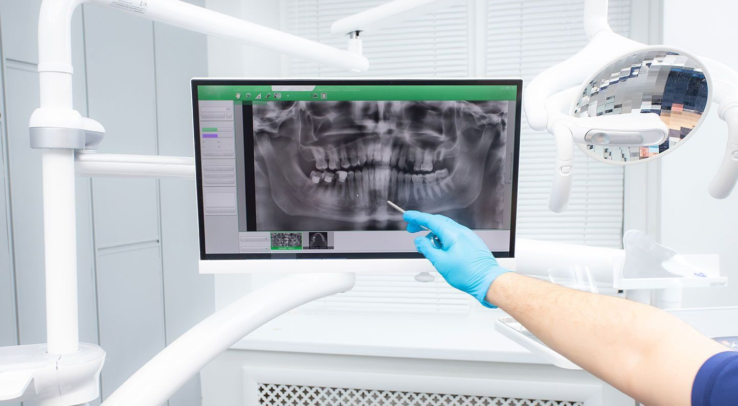 Dentiste qui fait voir une radio à son patient
