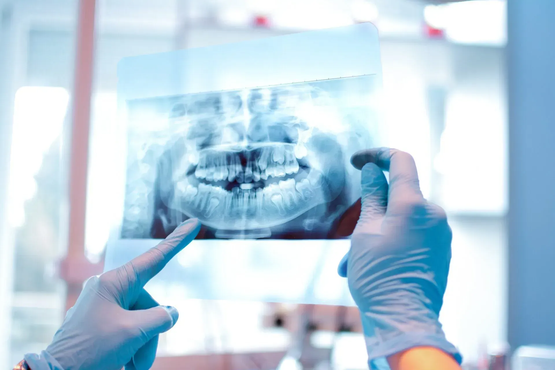 Dentiste tenant une radiographie