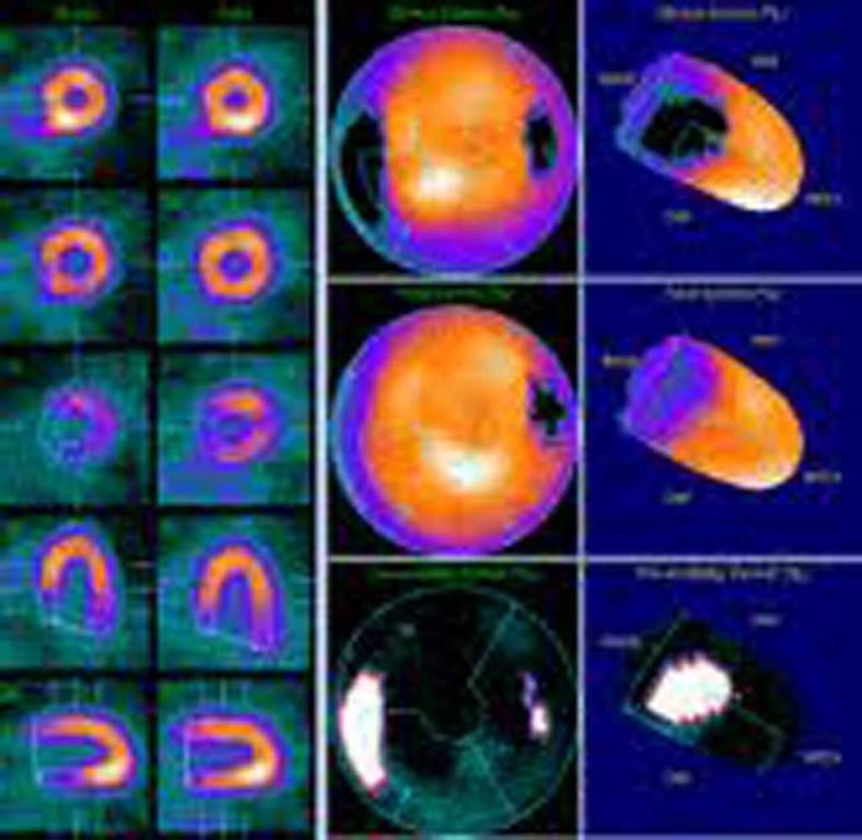 Dr A. Basti - Lausanne