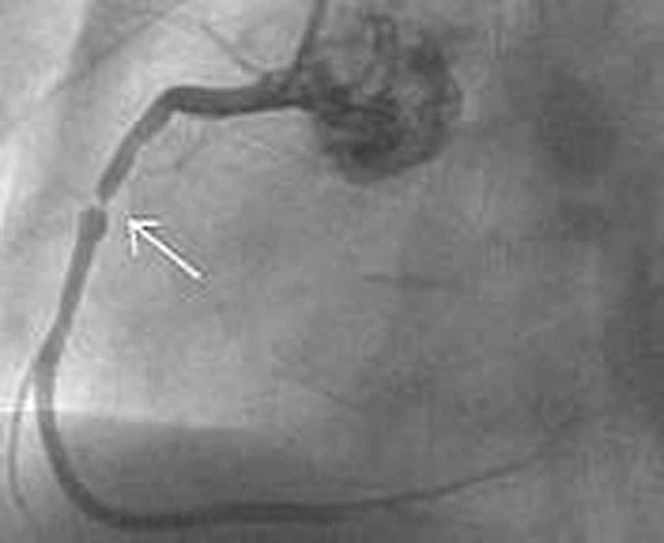 Dr A. Basti - Lausanne