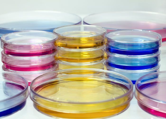 Un montón de placas de Petri llenas de líquidos de diferentes colores.