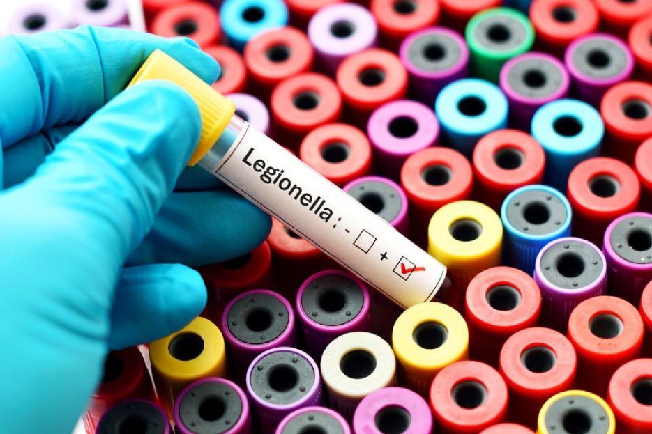 Una persona sostiene un tubo de ensayo que dice legionella.