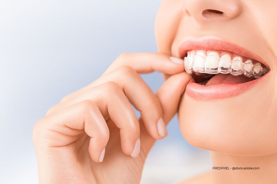 Frau probiert unsichtbare Spange von Zahnkompetenz Baramov aus