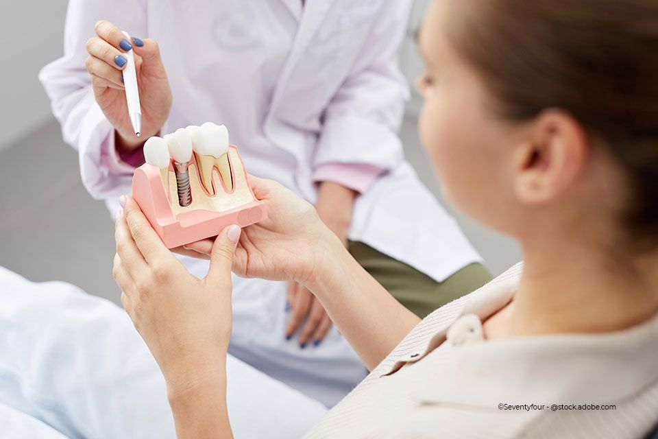 Die Patientin hält ein Modell eines Zahnimplantats in der Hand, während die Zahnärztin von Zahnkompetenz Baramov etwas erklärt.
