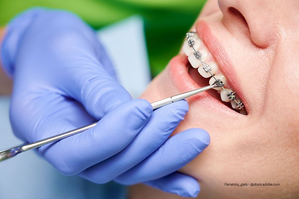 Zahnarzt von Zahnkompetenz Baramov kontrolliert die feste Zahnspange einer Patientin