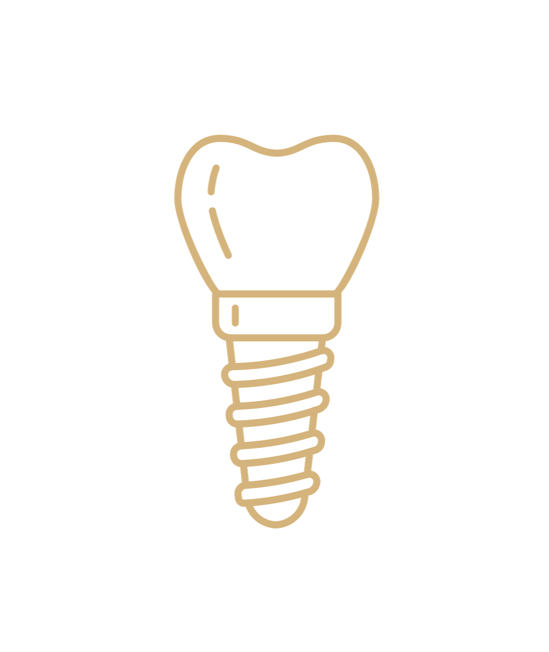 Zahnimplantat vom Zahnarzt in Fürth