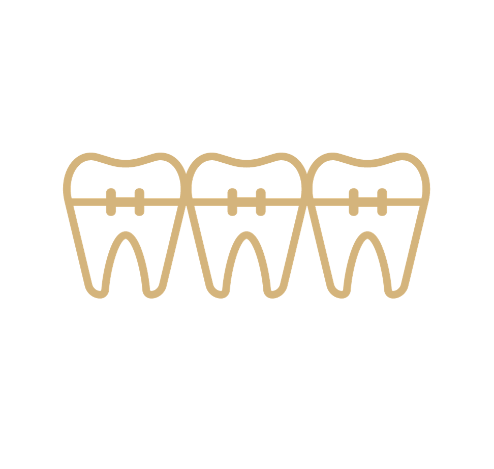 Zahnspange vom Kieferorthopäden