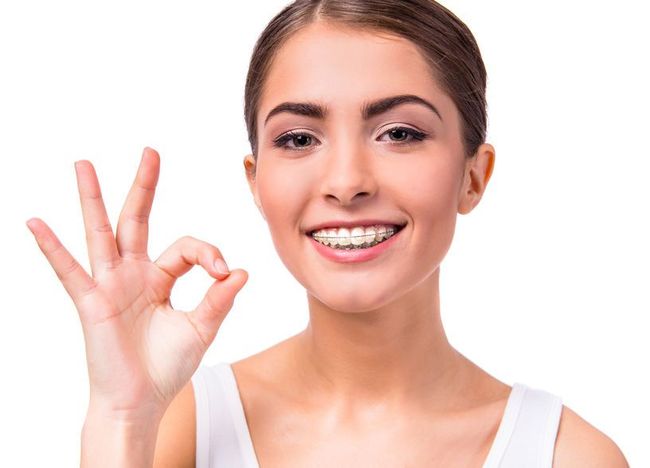 Una mujer con aparatos dentales está dando una señal de aprobación.