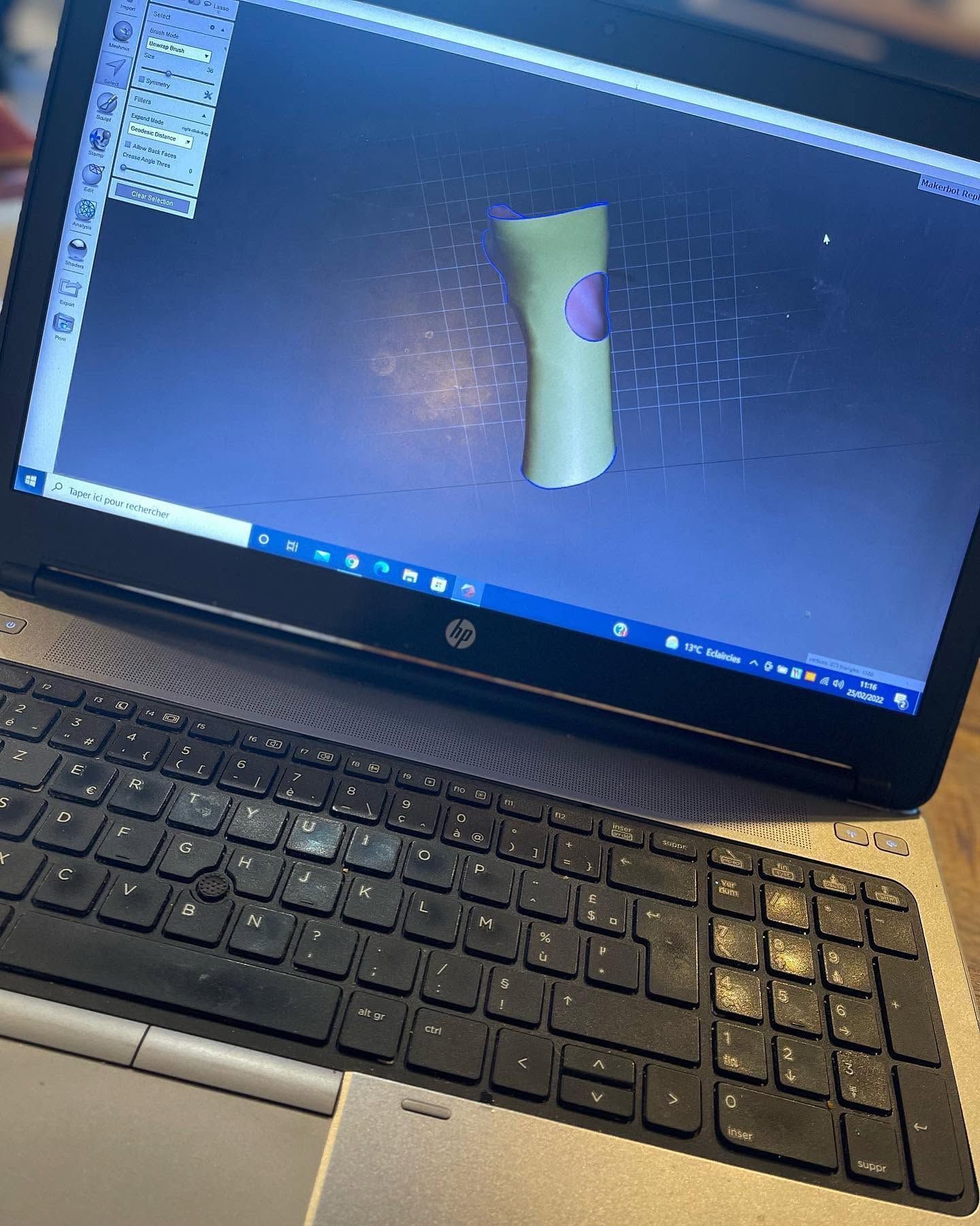Ordinateur portable affichant un logiciel de modélisation 3D pour la réalisation d'orthèse.
