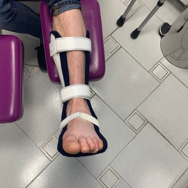 Jambe immobilisée par une attelle blanche et un bandage au pied, posée sur une chaise de consultation violette.