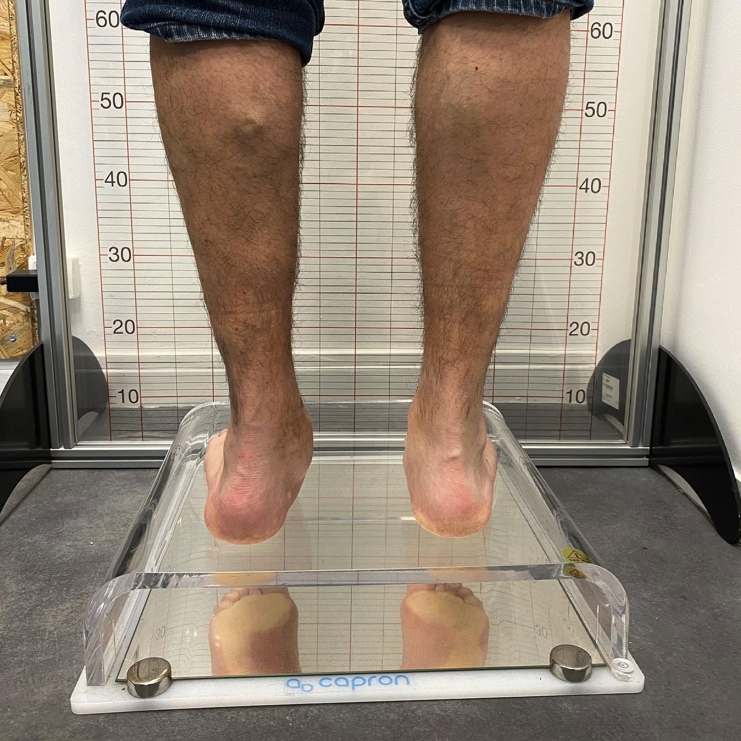 Personne debout sur une plateforme baropodométrique, mollets et pieds visibles.