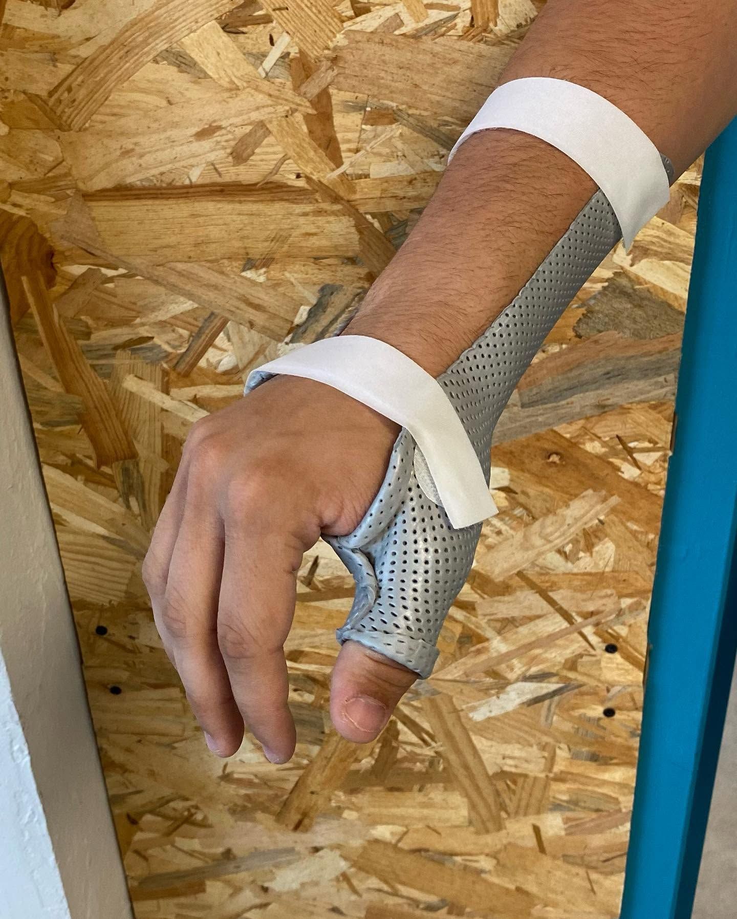Main immobilisée dans une attelle grise avec des sangles blanches autour du poignet et de l'avant-bras.