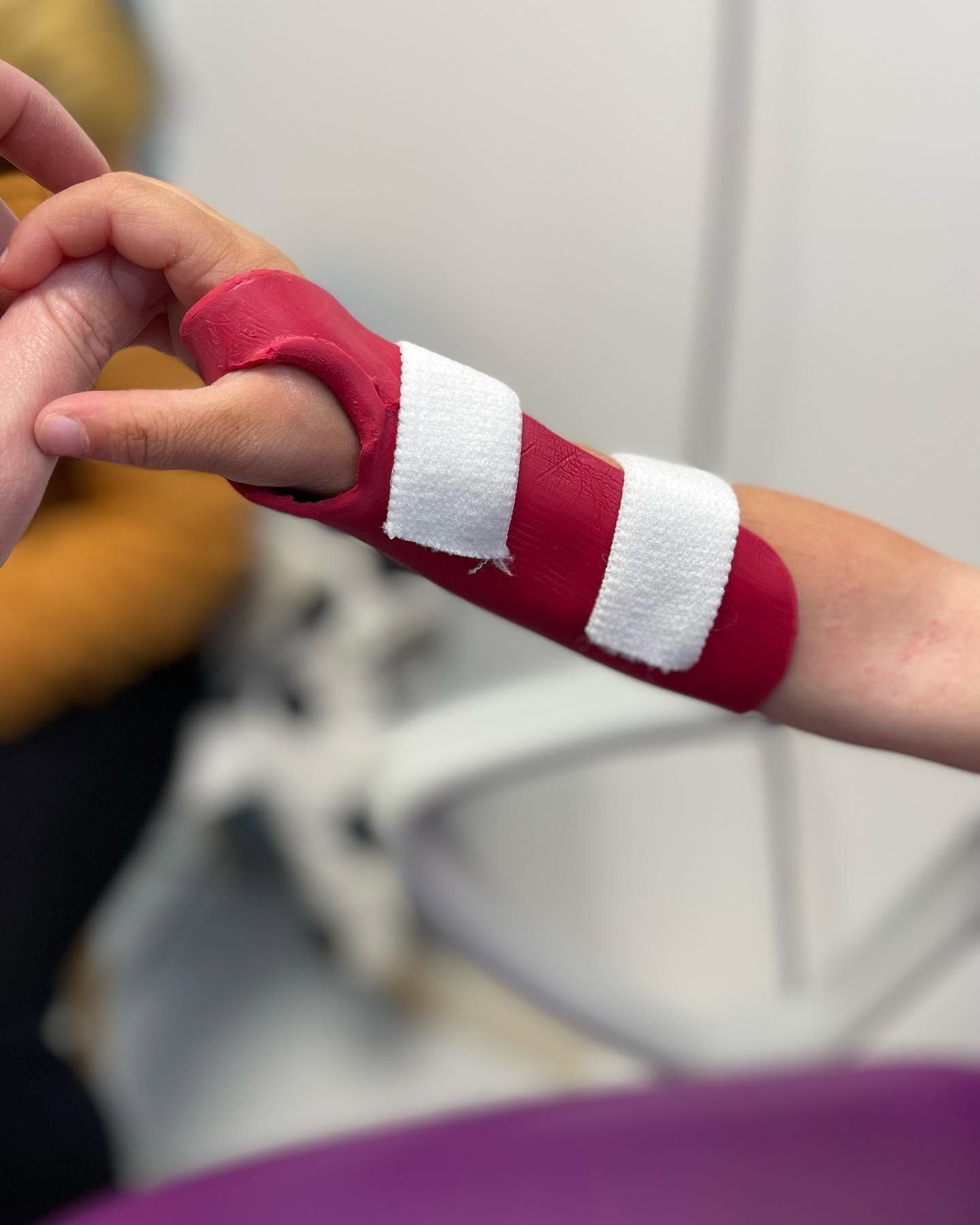 Bras bandé ou plâtré, main levée dans un contexte médical