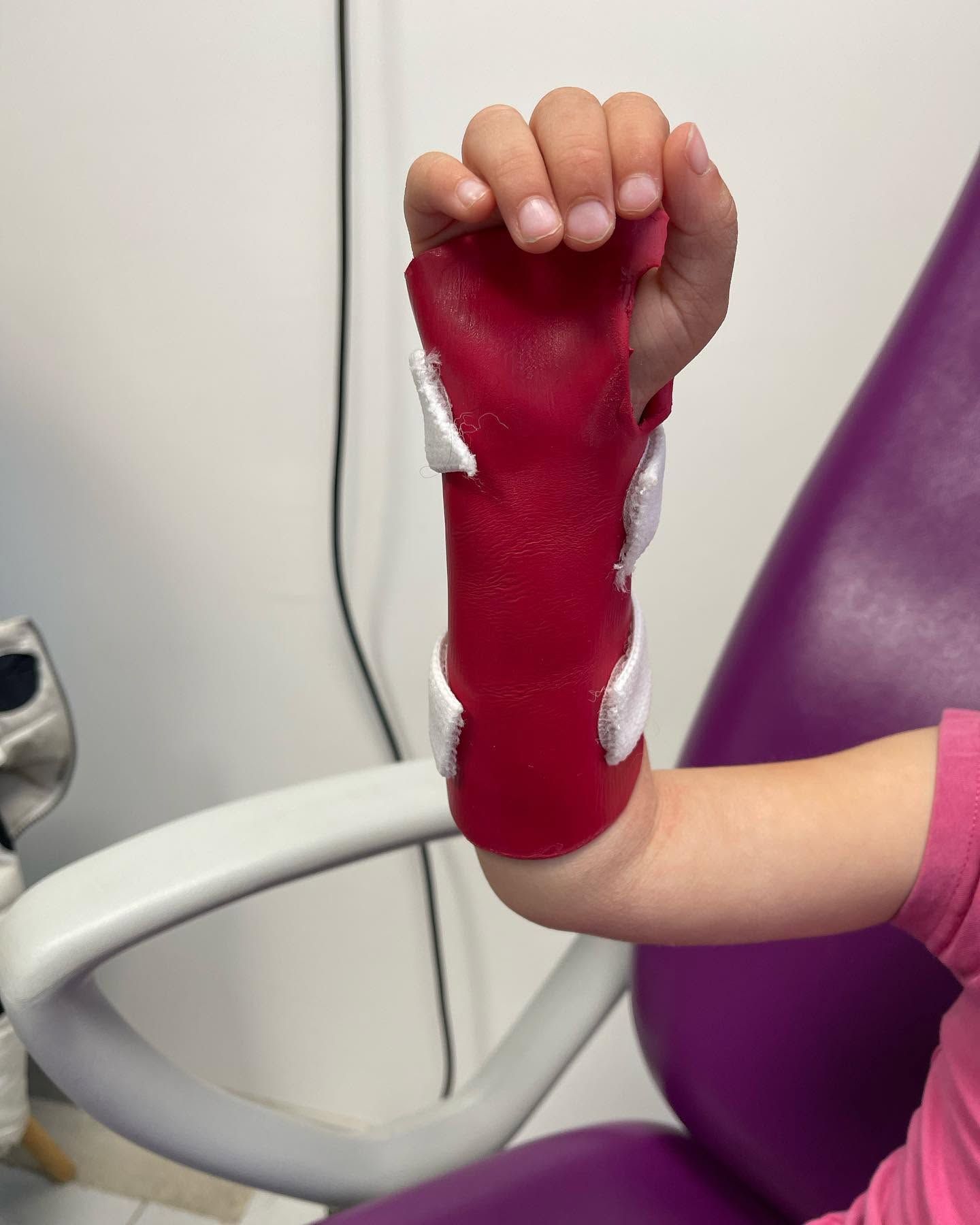 Main d'enfant portant une orthèse rouge à l'avant-bras et des sangles blanches.