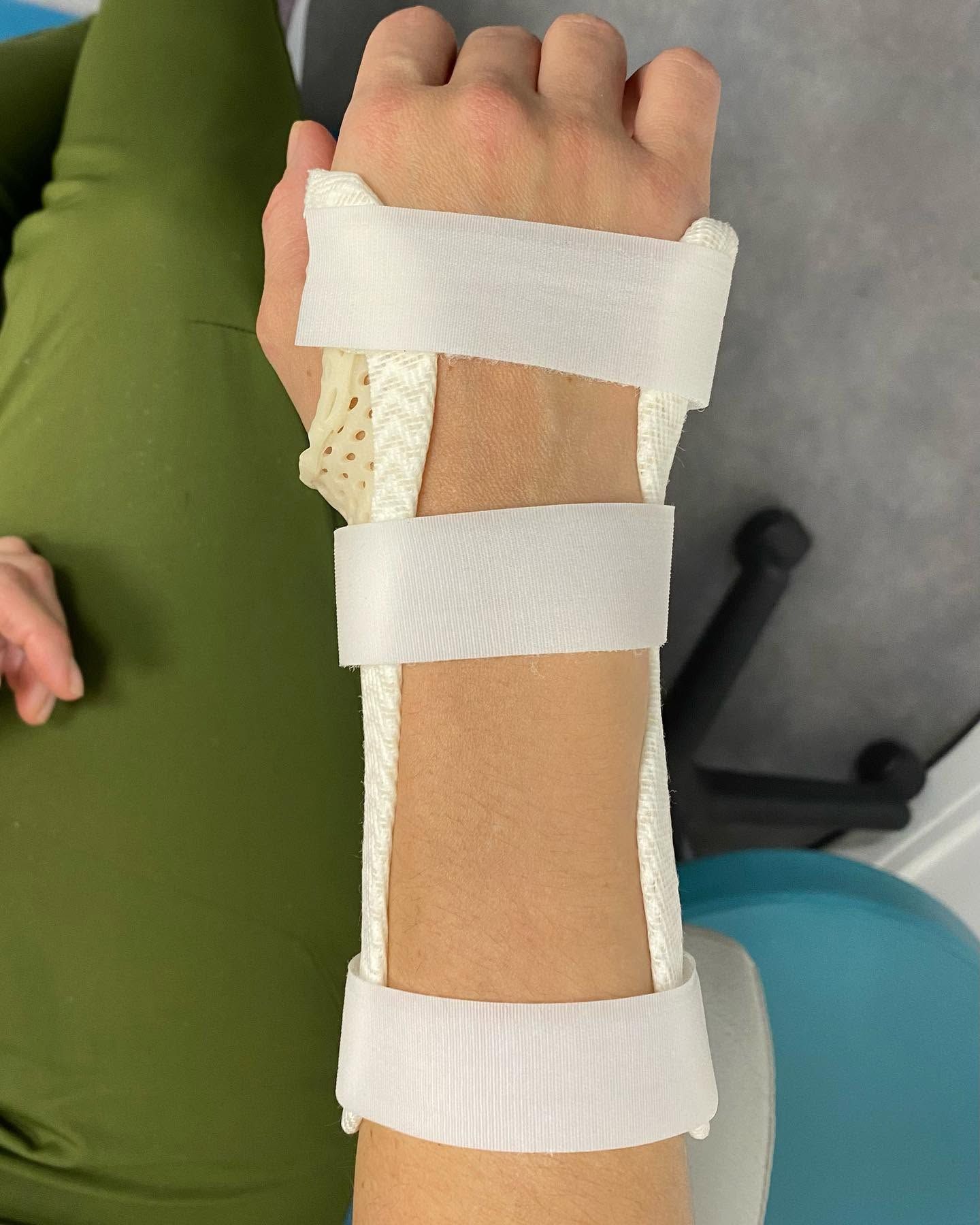 Avant-bras et poignet bandés reposant sur une chaise verte, avec une orthèse de soutien avec rembourrage.