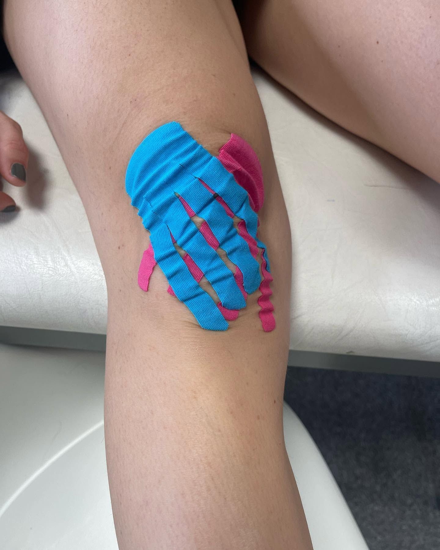 Bande de strapping bleue et rose sur un genou fléchi contre une table d'examen.