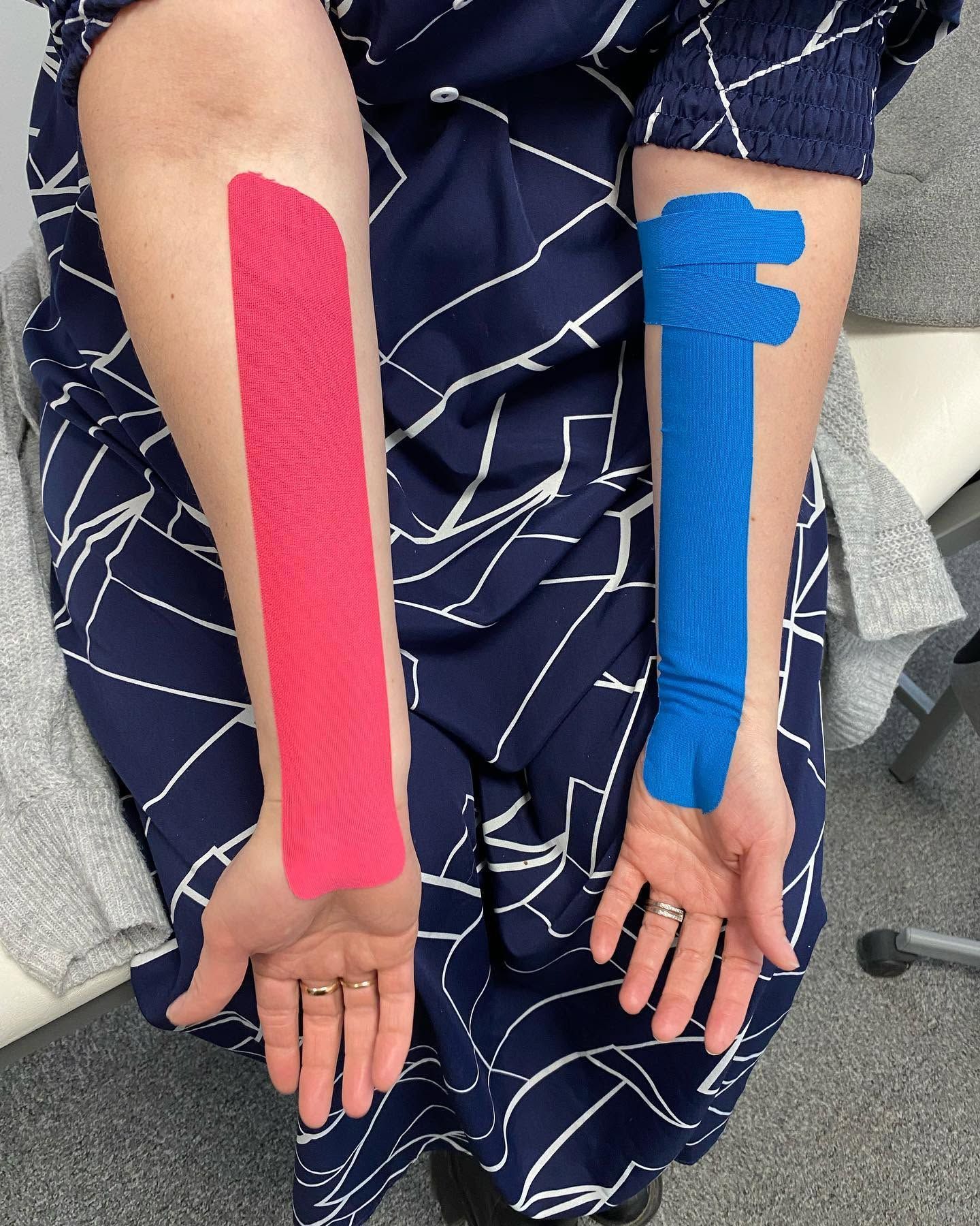 Bras recouverts de bandes de strapping rose vif et bleu, paumes vers le haut