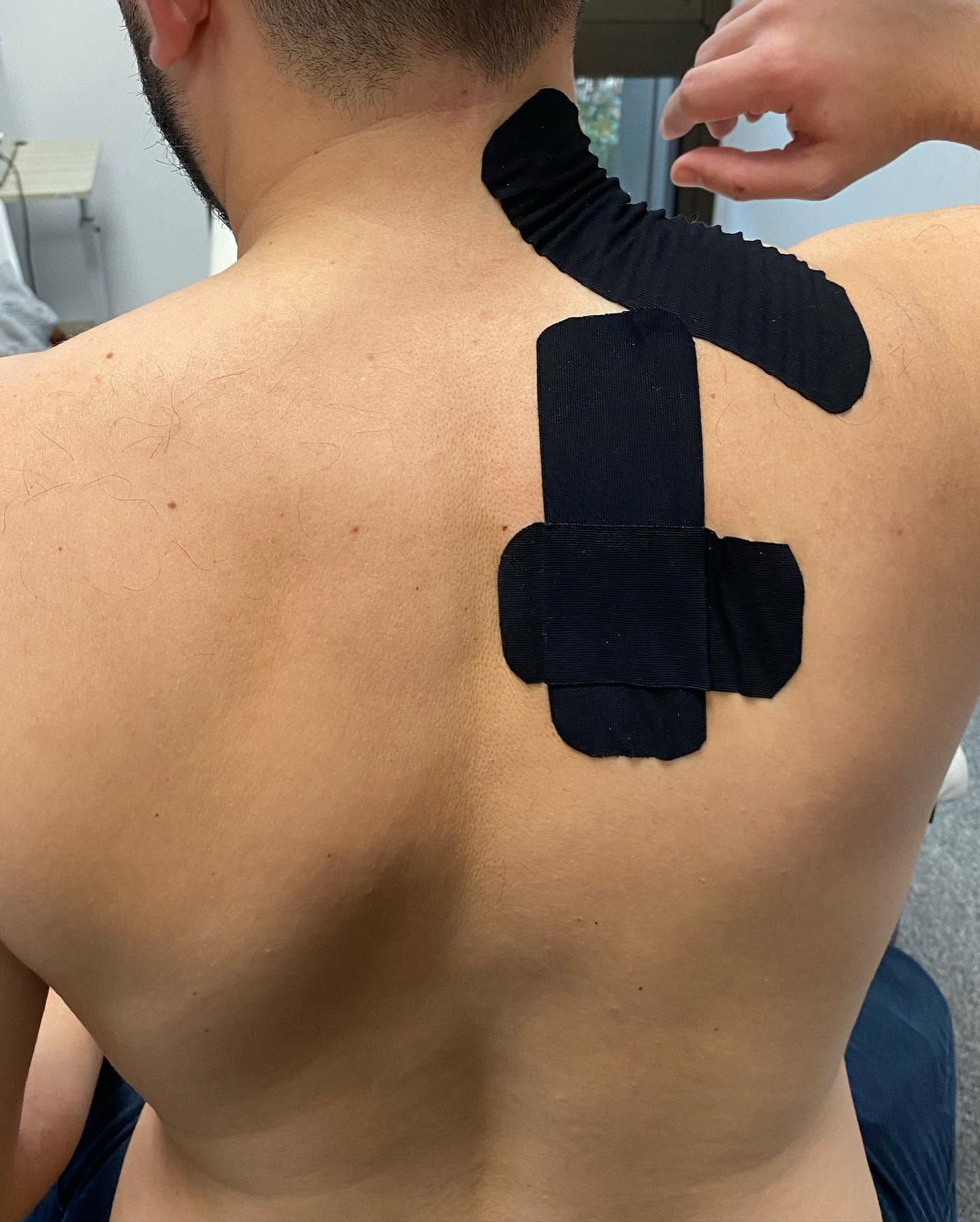 Dos d'une personne avec du strapping noir appliqué en diagonale sur le haut des épaules et la colonne vertébrale.