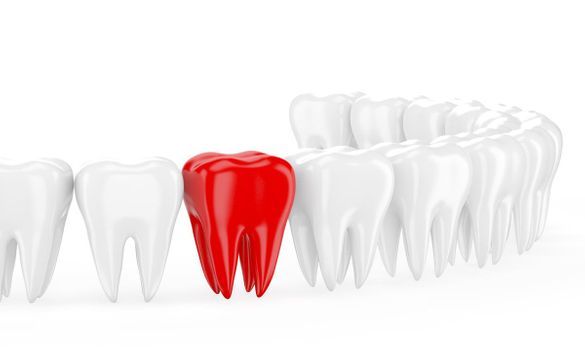 Zahnarztpraxis Kolski & Kolski Roter Zahn Schmerz