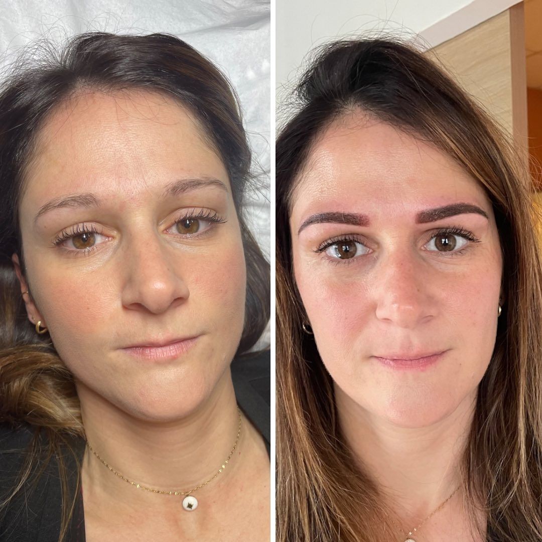 Avant/après sourcils