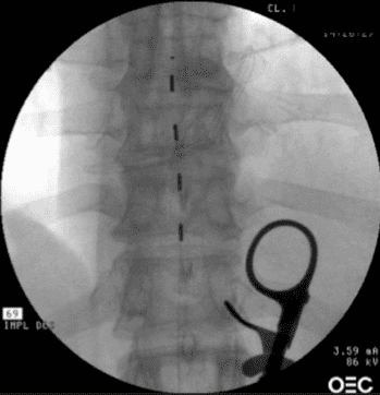 Centre anti-douleur Lausanne