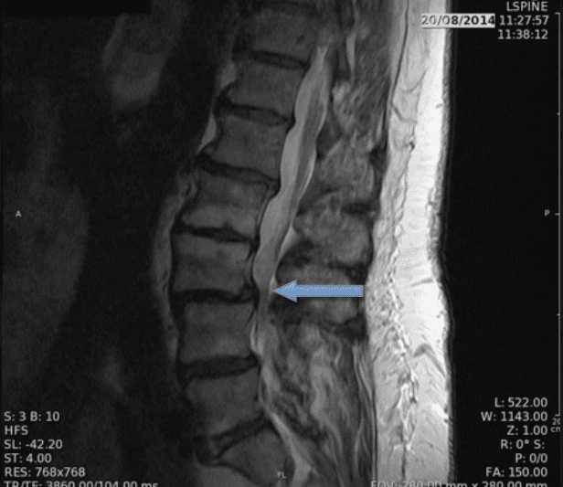 Centre anti-douleur Lausanne