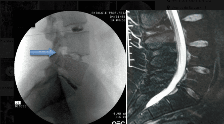 Centre anti-douleur Lausanne