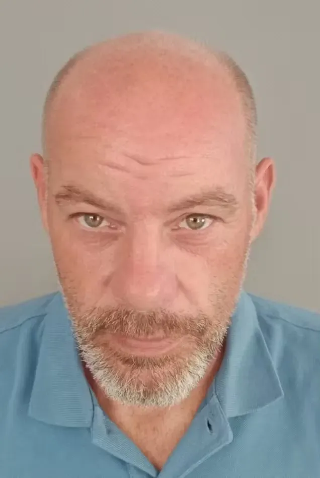 Hombre con cabeza calva, barba corta y gris, vestido con una camisa azul, mirando a la cámara con expresión seria.