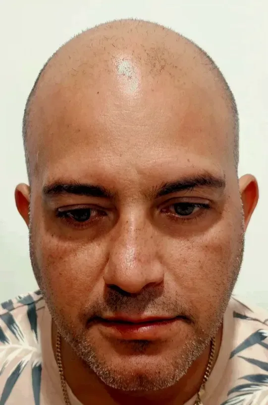 Hombre con cabeza calva, barba corta y gris, vestido con una camisa azul, mirando a la cámara con expresión seria.