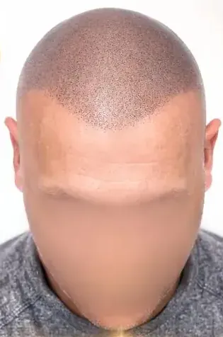 Hombre con cabeza rapada y barba incipiente mirando hacia adelante; camisa negra.