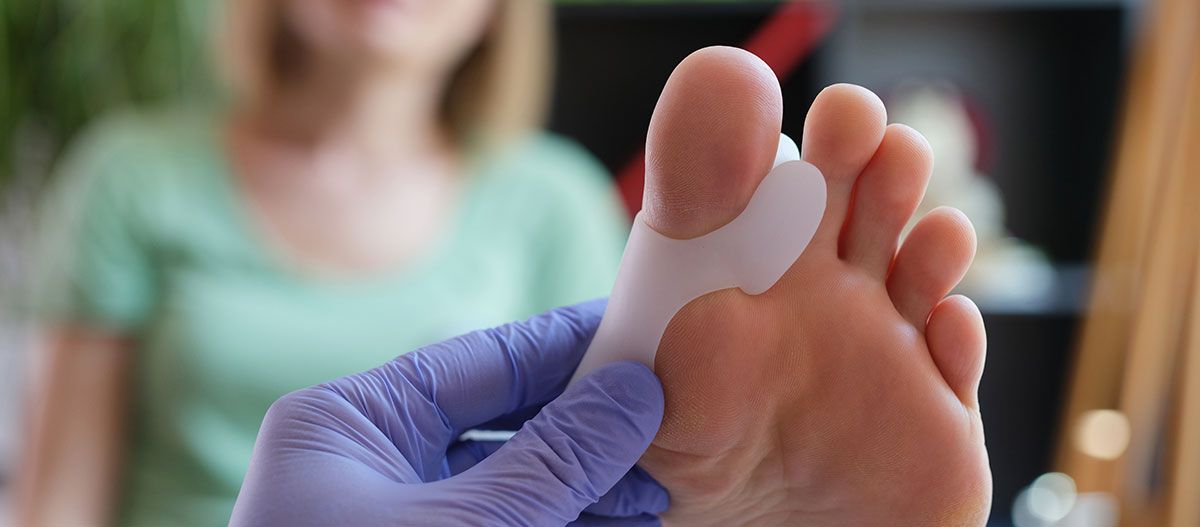 Orthopédiste appliquant une orthèse pour hallux valgus pour une patiente