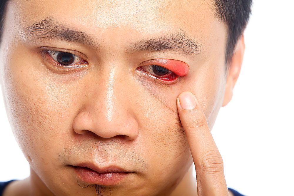 Ein Mann mit einem roten Auge berührt sein Auge mit seinem Finger.