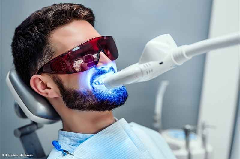 Mann unterzieht sich in einer Zahnarztpraxis einer Zahnaufhellungsbehandlung und trägt eine Schutzbrille.