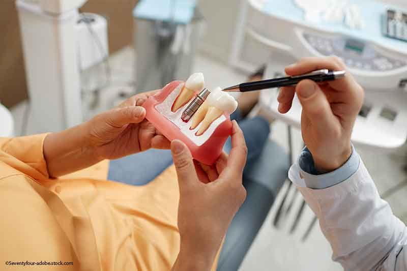 Zahnarzt zeigt auf Modellzähne, die der Patient hält; Zahnarztpraxis-Setting.