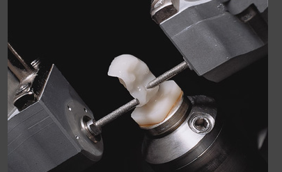 Zahntechnologie - Zahnärztecenter Harry Frey