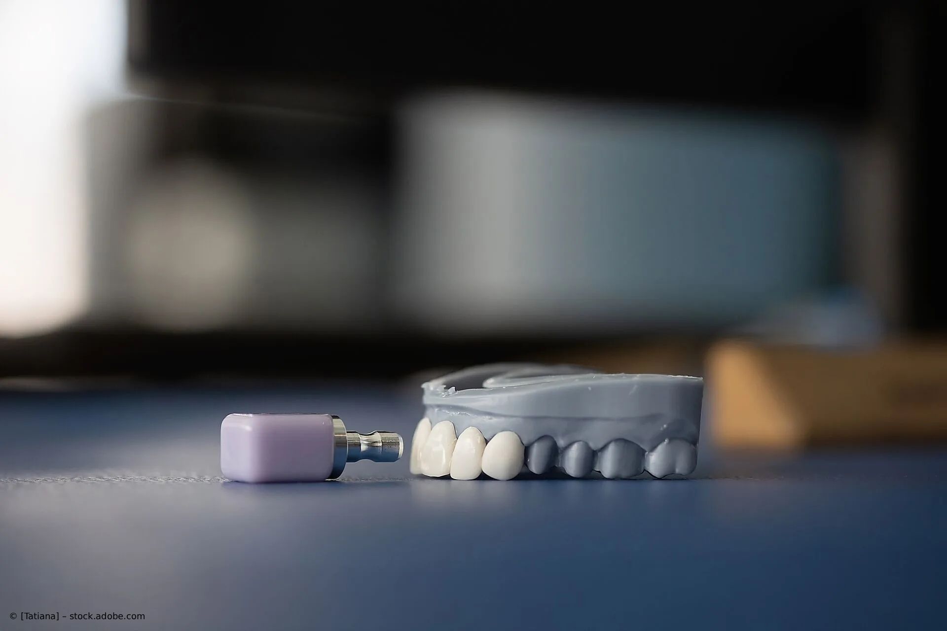 Eine Zahnabformung mit Zähnen und einem kleinen violetten Verbindungsstück auf blauem Grund, verschwommener Hintergrund